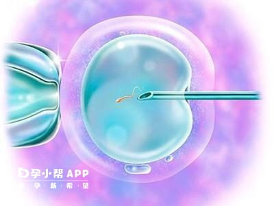 格鲁吉亚能做试管婴儿